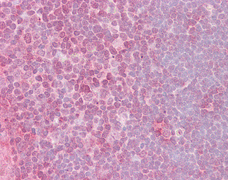 CrkL Antibody in Immunohistochemistry (Paraffin) (IHC (P))