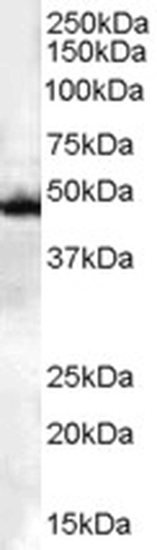 CSK Antibody in Western Blot (WB)