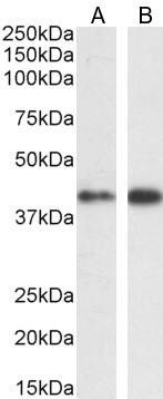 ERK1 Antibody in Western Blot (WB)