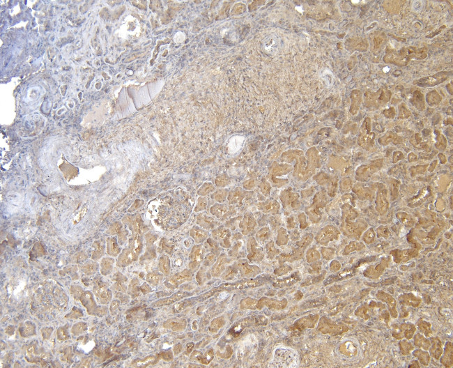 FOXO3A Antibody in Immunohistochemistry (Paraffin) (IHC (P))