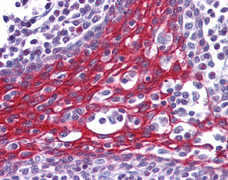 FOXO3A Antibody in Immunohistochemistry (Paraffin) (IHC (P))