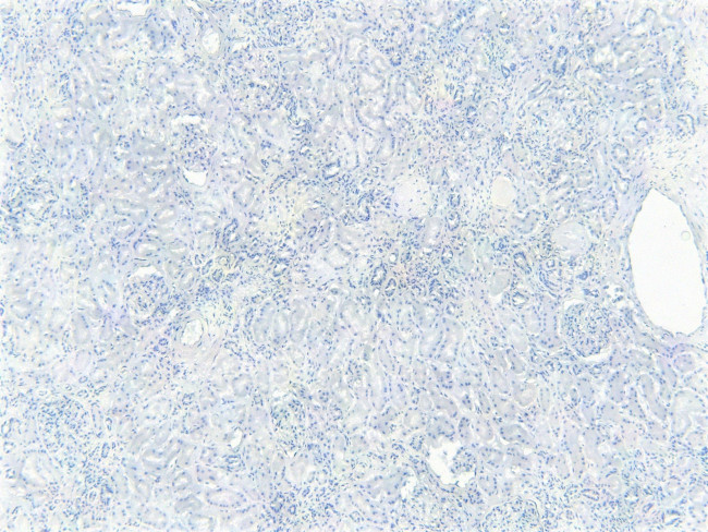 FOXO3A Antibody in Immunohistochemistry (Paraffin) (IHC (P))