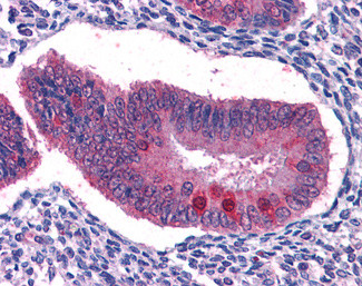 FOXO3A Antibody in Immunohistochemistry (Paraffin) (IHC (P))