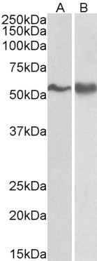 Fyn Antibody in Western Blot (WB)