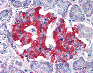 GRB2 Antibody in Immunohistochemistry (Paraffin) (IHC (P))