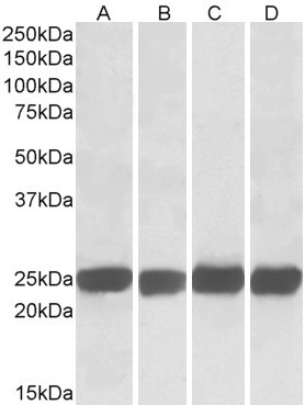 GRB2 Antibody in Western Blot (WB)