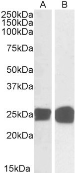 GRB2 Antibody in Western Blot (WB)