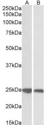 GRB2 Antibody in Western Blot (WB)