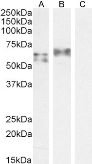 IRF5 Antibody in Western Blot (WB)