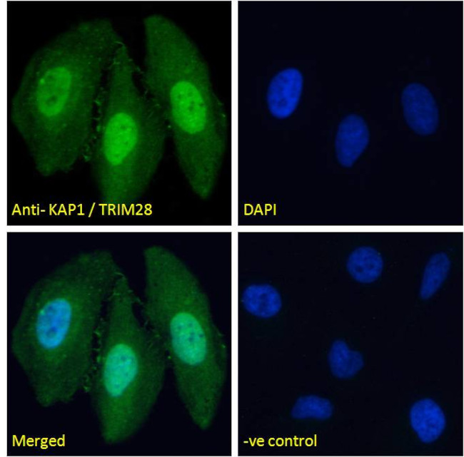 TRIM28 Antibody in Immunocytochemistry (ICC/IF)