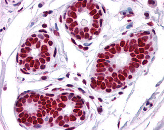 TRIM28 Antibody in Immunohistochemistry (Paraffin) (IHC (P))