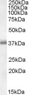 LAT Antibody in Western Blot (WB)