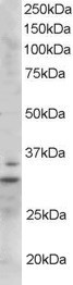 LIME Antibody in Western Blot (WB)