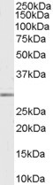 MMP7 Antibody in Western Blot (WB)