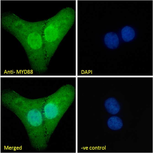 MyD88 Antibody in Immunocytochemistry (ICC/IF)