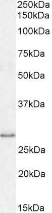 MyD88 Antibody in Western Blot (WB)