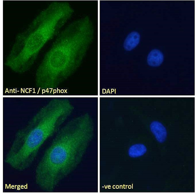 p47phox Antibody in Immunocytochemistry (ICC/IF)