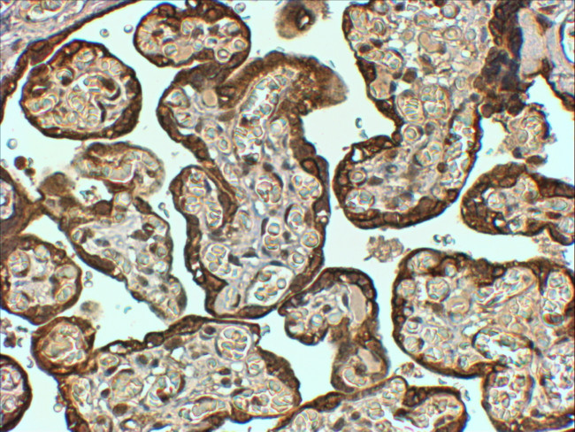 PAI1 Antibody in Immunohistochemistry (Paraffin) (IHC (P))