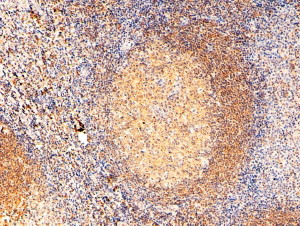 RAC2 Antibody in Immunohistochemistry (Paraffin) (IHC (P))