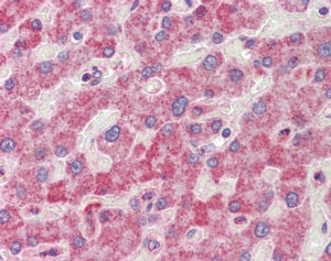 RANGAP1 Antibody in Immunohistochemistry (Paraffin) (IHC (P))