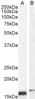 RBP1 Antibody in Western Blot (WB)