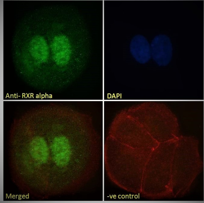 RXRA Antibody in Immunocytochemistry (ICC/IF)