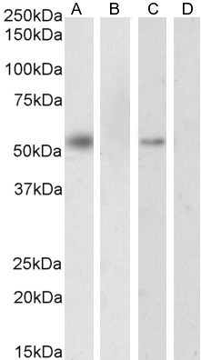 RXRA Antibody in Western Blot (WB)