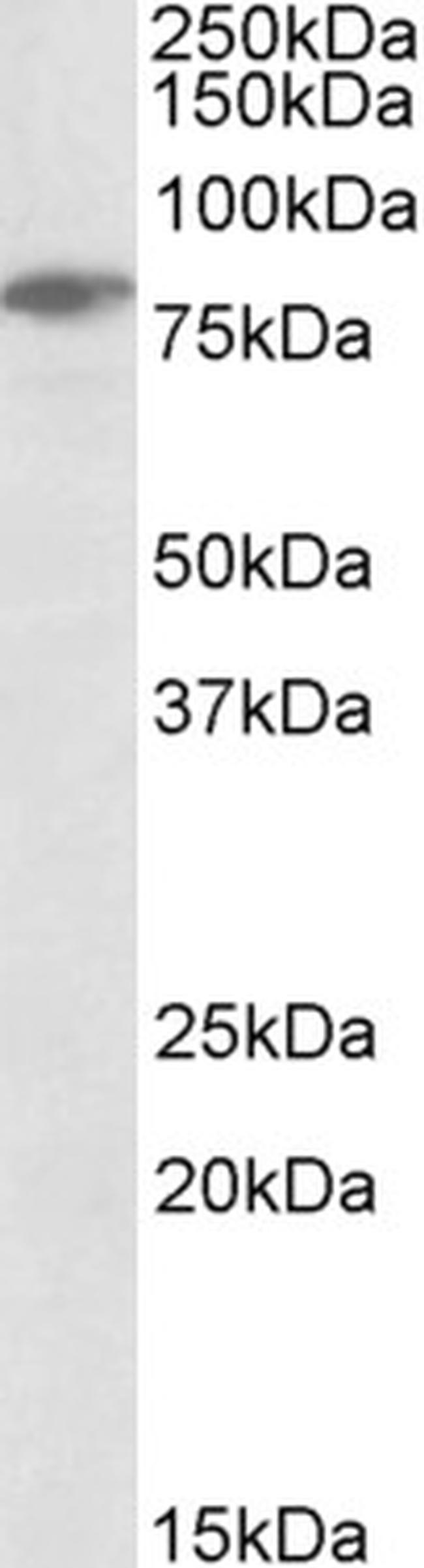 SLP76 Antibody in Western Blot (WB)