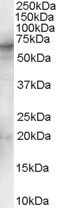 Syk Antibody in Western Blot (WB)