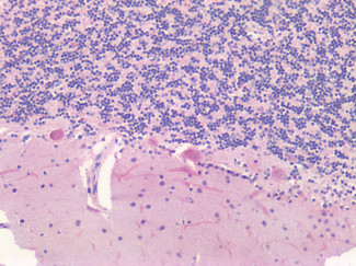 Survivin Antibody in Immunohistochemistry (Paraffin) (IHC (P))