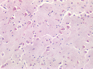 Survivin Antibody in Immunohistochemistry (Paraffin) (IHC (P))