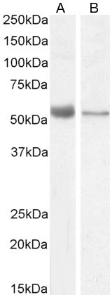 VDR Antibody in Western Blot (WB)