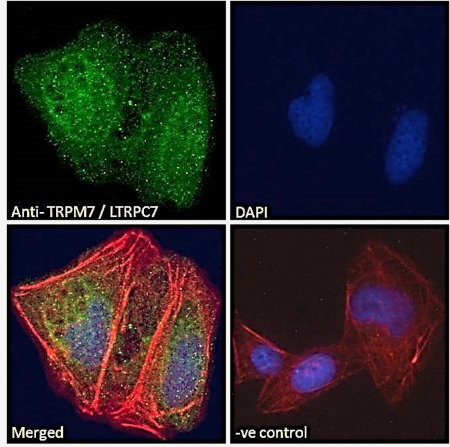 TRPM7 Antibody in Immunocytochemistry (ICC/IF)