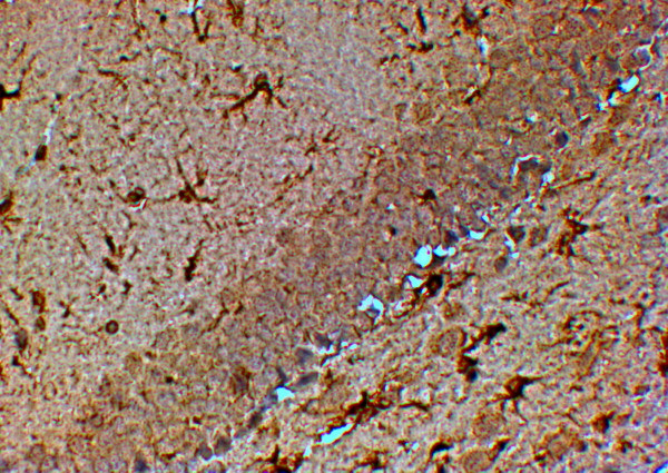 TRPM7 Antibody in Immunohistochemistry (Paraffin) (IHC (P))