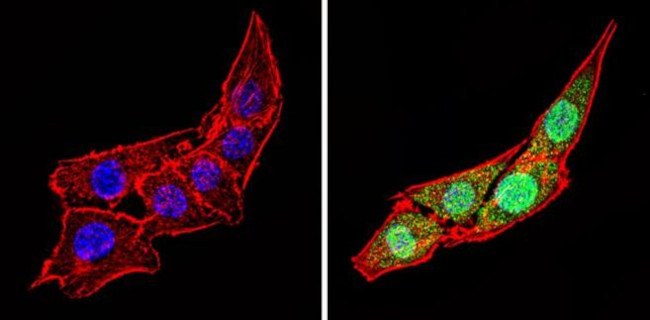 Calsequestrin Antibody in Immunocytochemistry (ICC/IF)