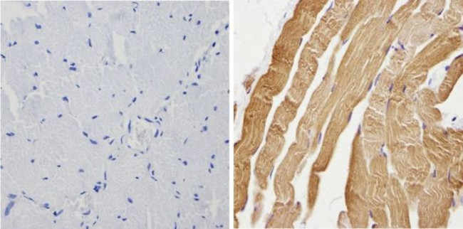 Calsequestrin Antibody in Immunohistochemistry (Paraffin) (IHC (P))