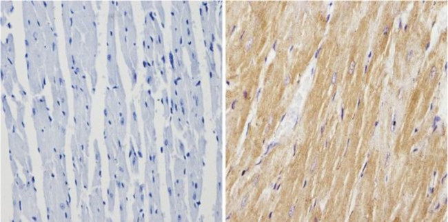 Calsequestrin Antibody in Immunohistochemistry (Paraffin) (IHC (P))