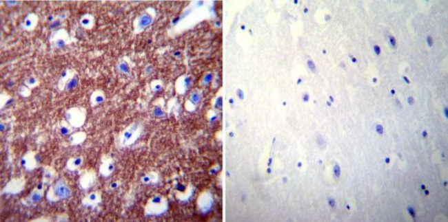 PMCA2 ATPase Antibody in Immunohistochemistry (Paraffin) (IHC (P))