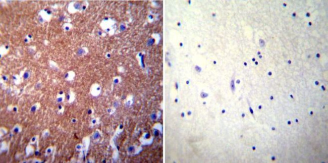 PMCA3 ATPase Antibody in Immunohistochemistry (Paraffin) (IHC (P))