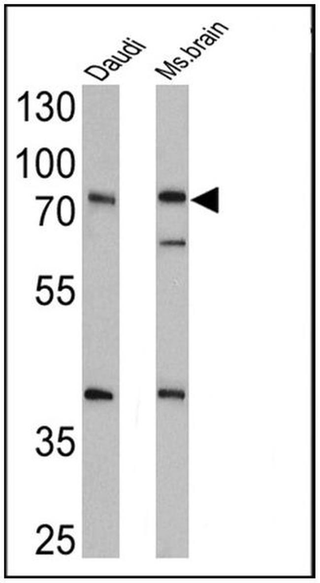 alpha-ENaC Antibody in Western Blot (WB)