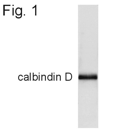 Calbindin D28K Antibody in Western Blot (WB)