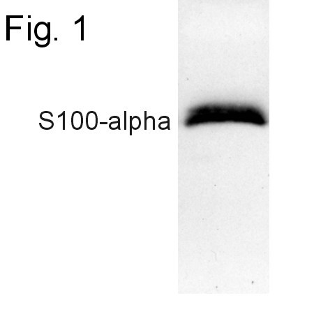 S100A1 Antibody in Western Blot (WB)