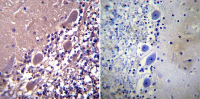 Parvalbumin Antibody in Immunohistochemistry (Paraffin) (IHC (P))