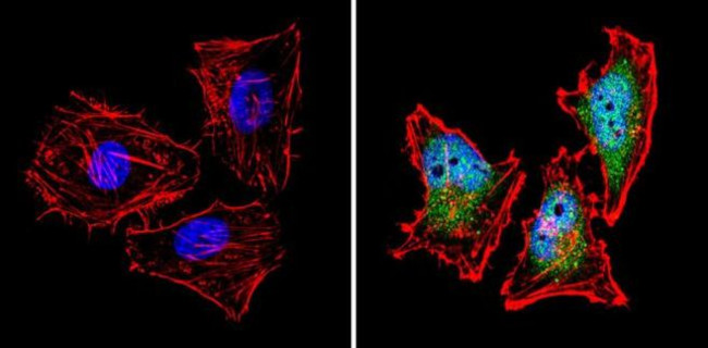 Calcium Sensing Receptor Antibody in Immunocytochemistry (ICC/IF)