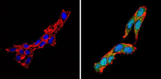 Calcium Sensing Receptor Antibody in Immunocytochemistry (ICC/IF)