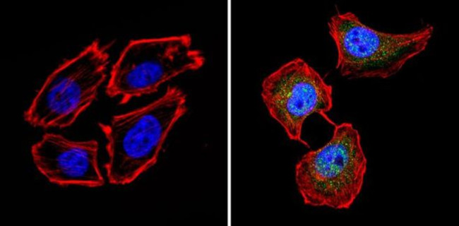 Calcium Sensing Receptor Antibody in Immunocytochemistry (ICC/IF)