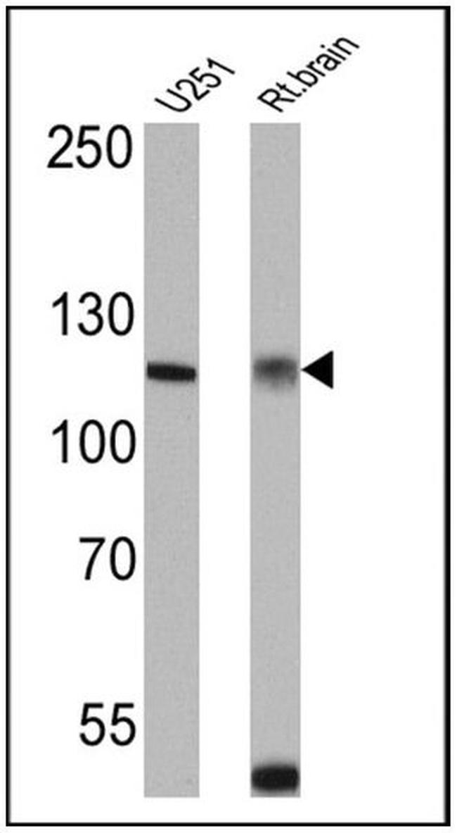 Calcium Sensing Receptor Antibody in Western Blot (WB)