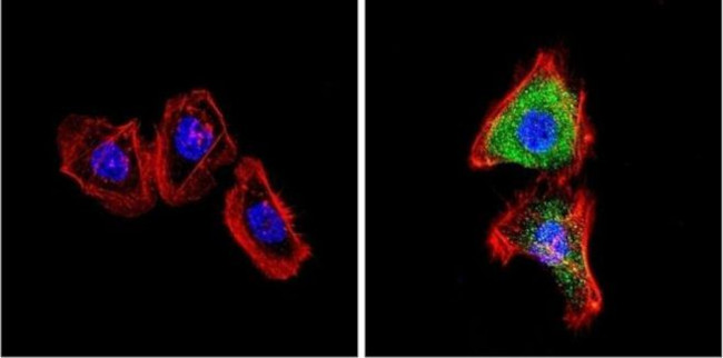 VDAC Antibody in Immunocytochemistry (ICC/IF)