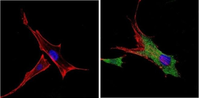 VDAC Antibody in Immunocytochemistry (ICC/IF)