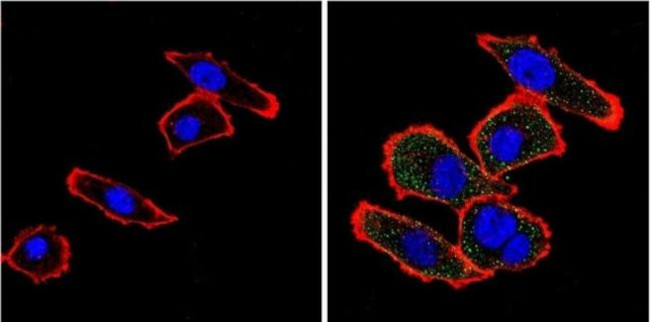 VDAC Antibody in Immunocytochemistry (ICC/IF)